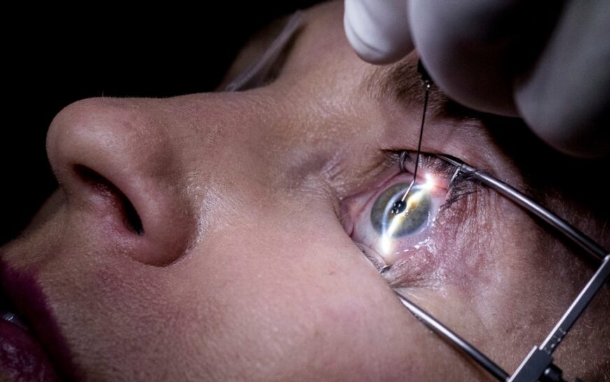 Garissa Referral Hospital to Host Advanced Eye Surgery Camp